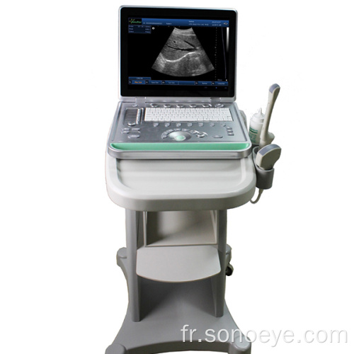 Scanner à ultrasons de chariot numérique